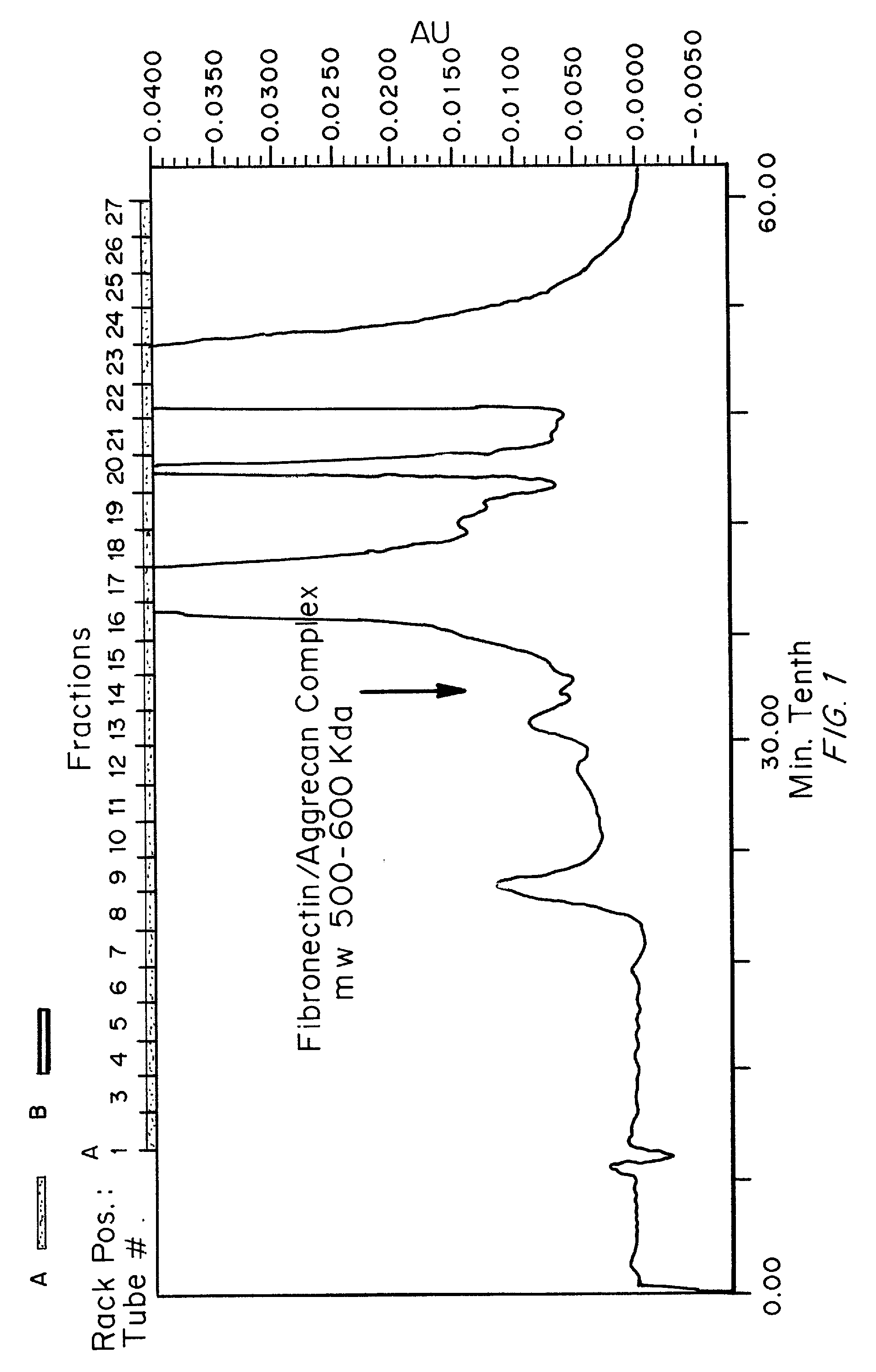 Biomarkers and methods for detecting and treating spinal and joint pain