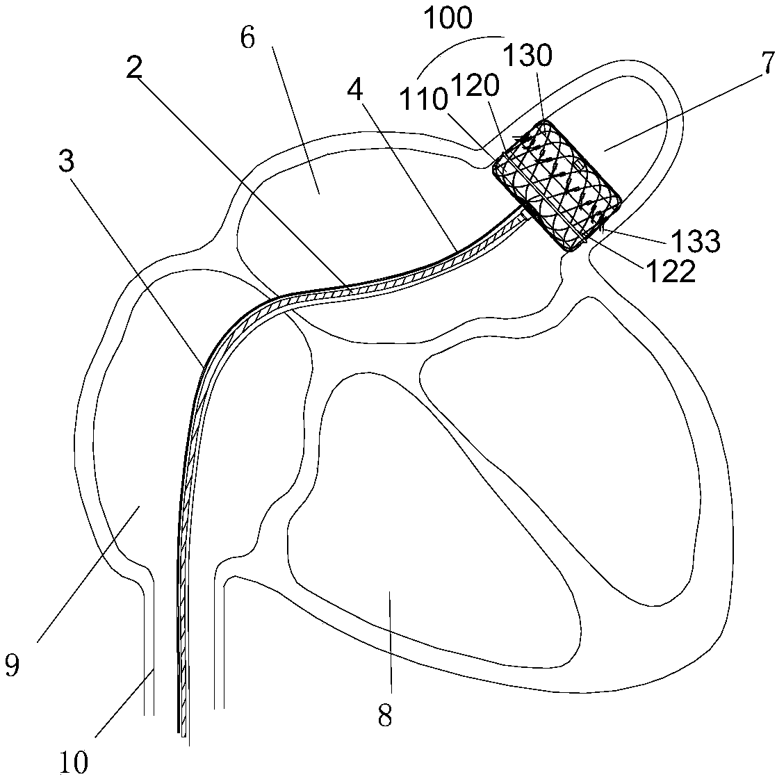 Left atrial appendage occlusion and ablation device