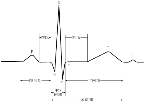 An electrocardiogram p-wave detection method, analysis device and storage medium