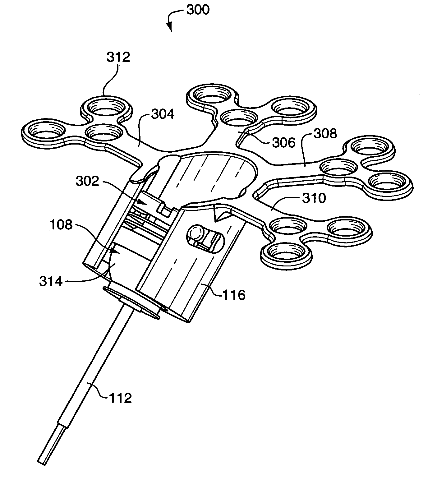 Implantable hearing aid transducer retention apparatus