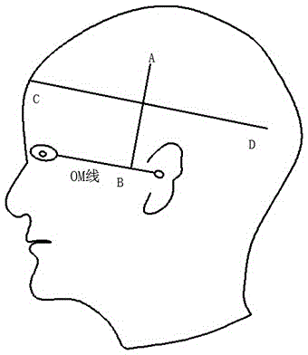 Cranial periphery position finder