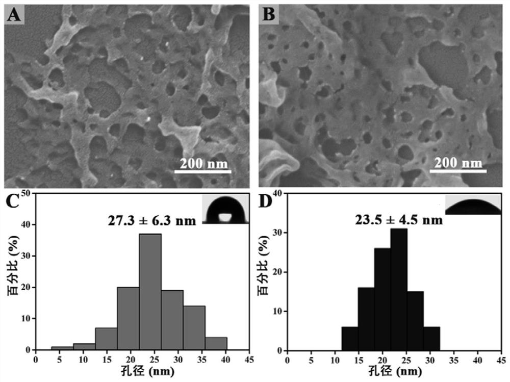 Hydrophilic negatively-charged porous nano-film for repairing chronic kidney disease as well as preparation method and application of hydrophilic negatively-charged porous nano-film