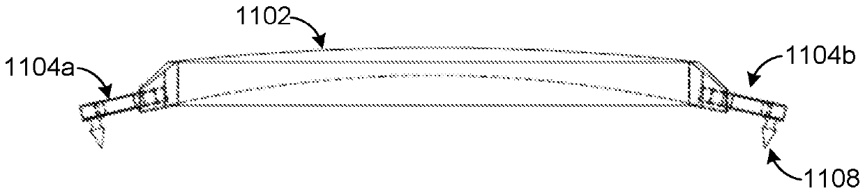 Intraocular pseudophakic contact lens with mechanism for securing by anterior leaflet of capsular wall and related system and method