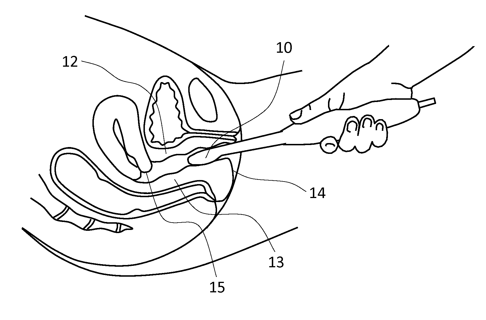 Methods for characterizing vaginal tissue elasticity
