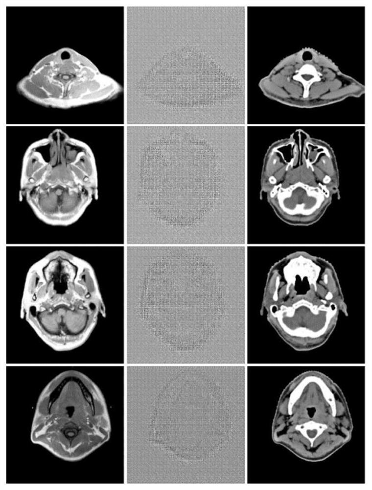 MRI image and CT image conversion method and terminal based on deep learning