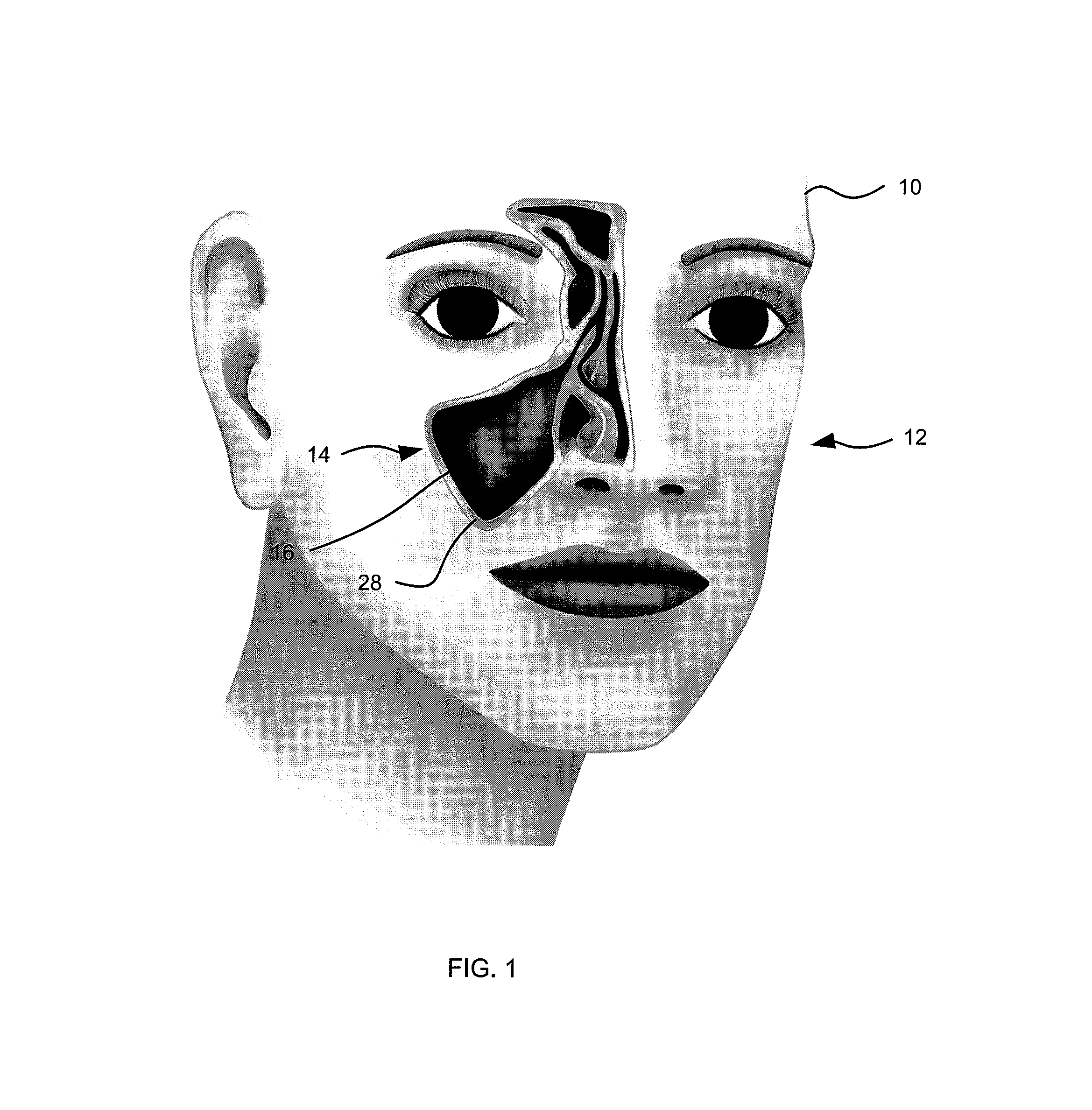 Apparatus and method for accessing a sinus cavity