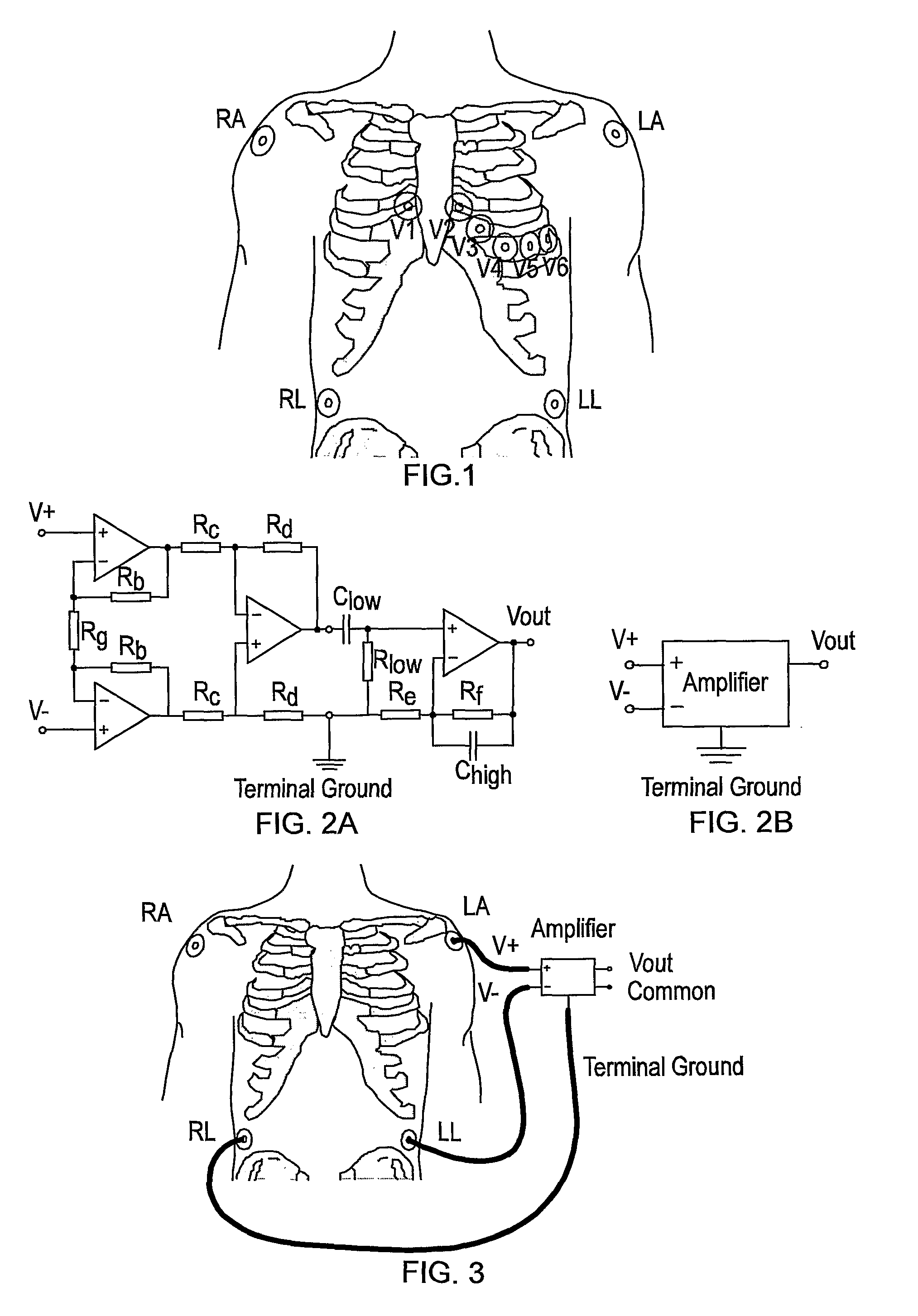 System and method for wireless generation of standard ECG leads and an ECG sensing unit therefor
