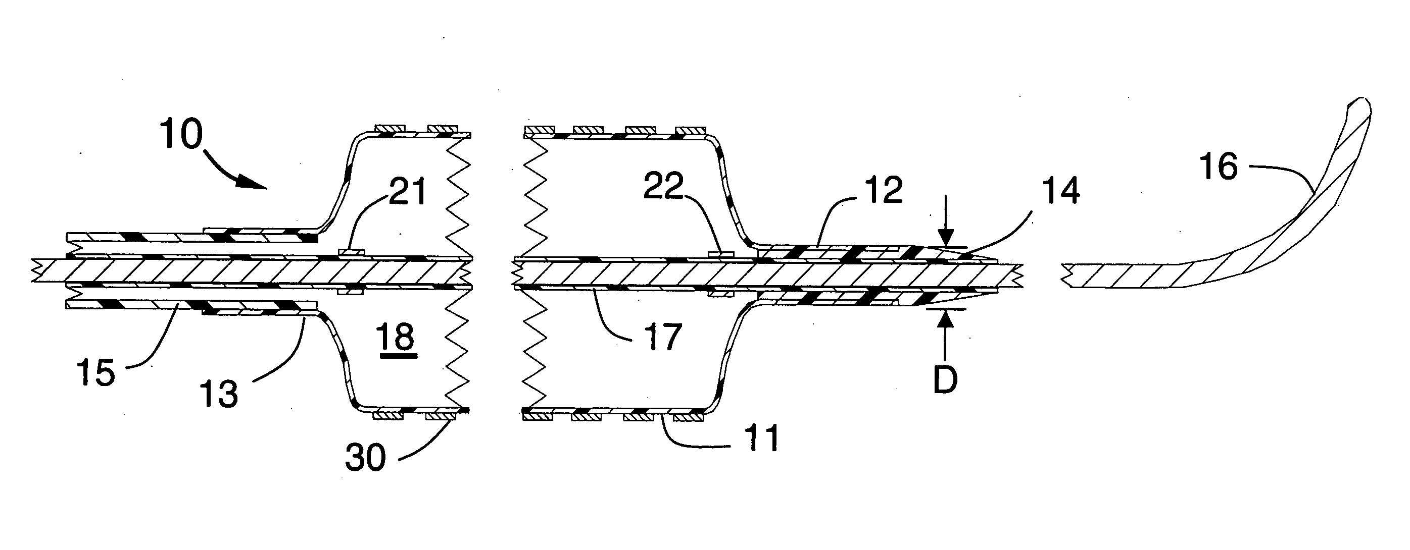 Stent delivery system using a steerable guide wire