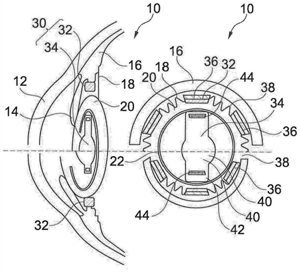Intraocular lens system, intraocular lens and ciliary body implant