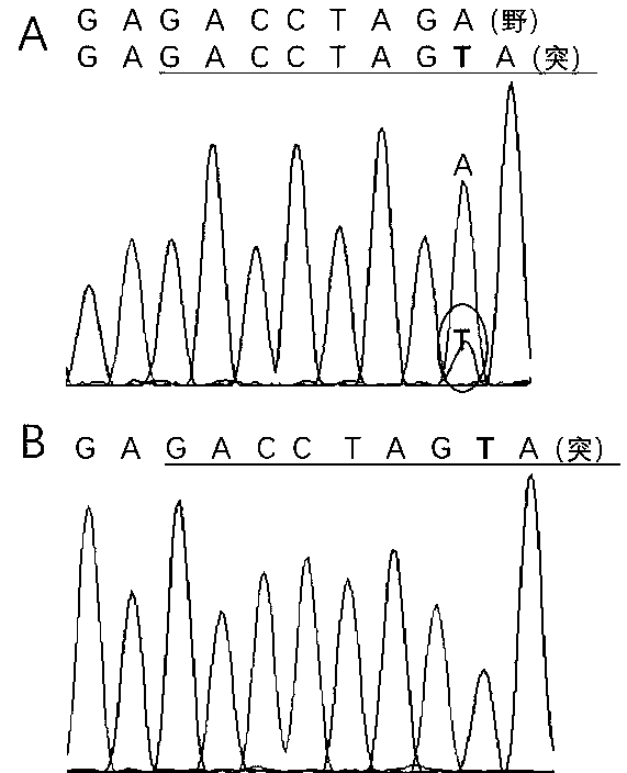 JAK1 gene specific mutation detection kit and detection method thereof
