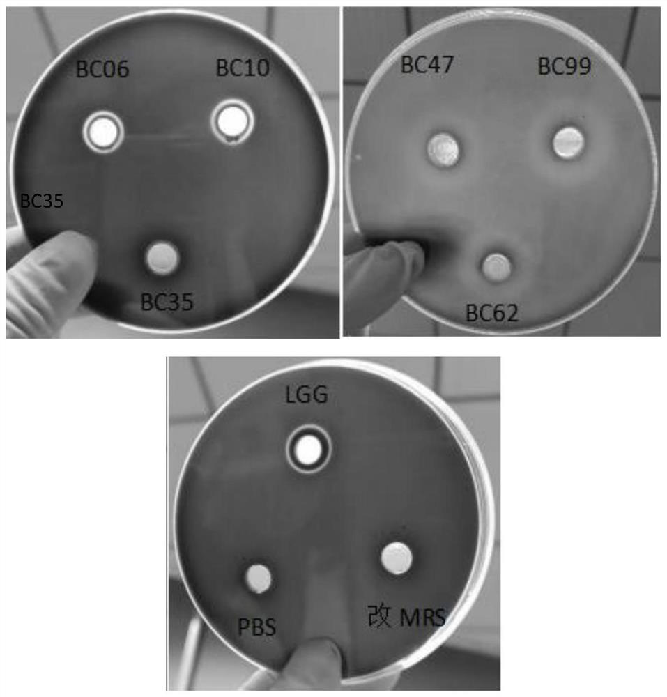 Anti-helicobacter pylori bacillus coagulans BC99 and application thereof