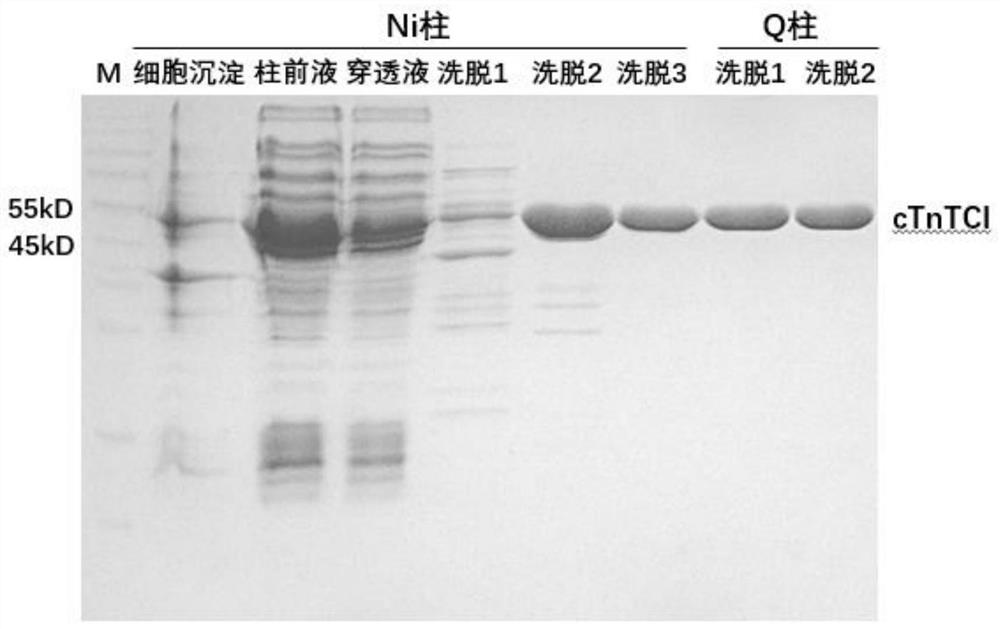 ctni-ctnc-ctnt trimer protein and its preparation method and ctni detection kit