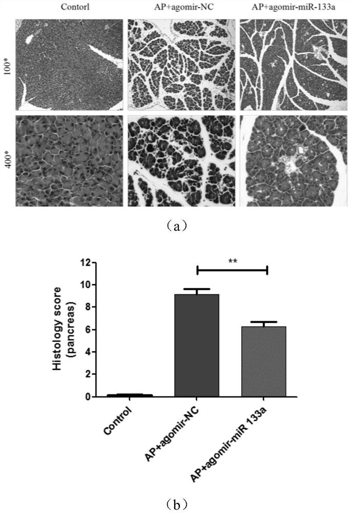 MiRNA for preventing and/or treating acute pancreatitis, and pharmaceutical application of MiRNA