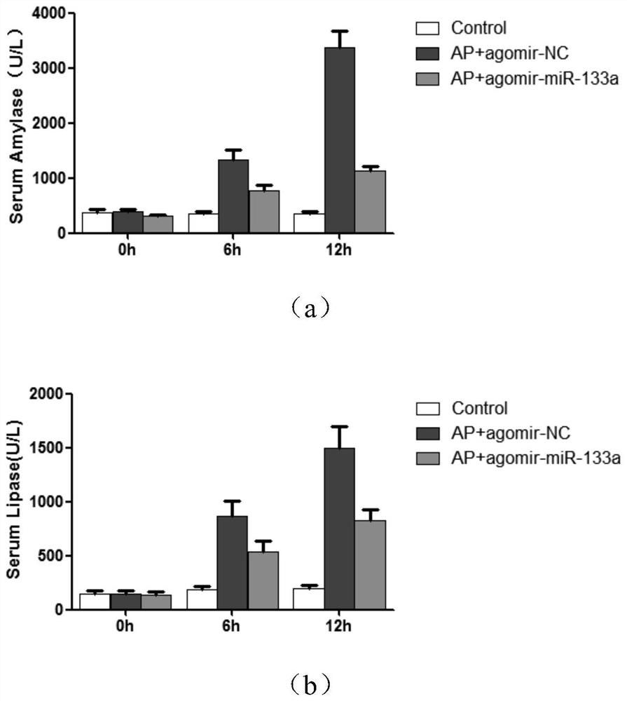 MiRNA for preventing and/or treating acute pancreatitis, and pharmaceutical application of MiRNA