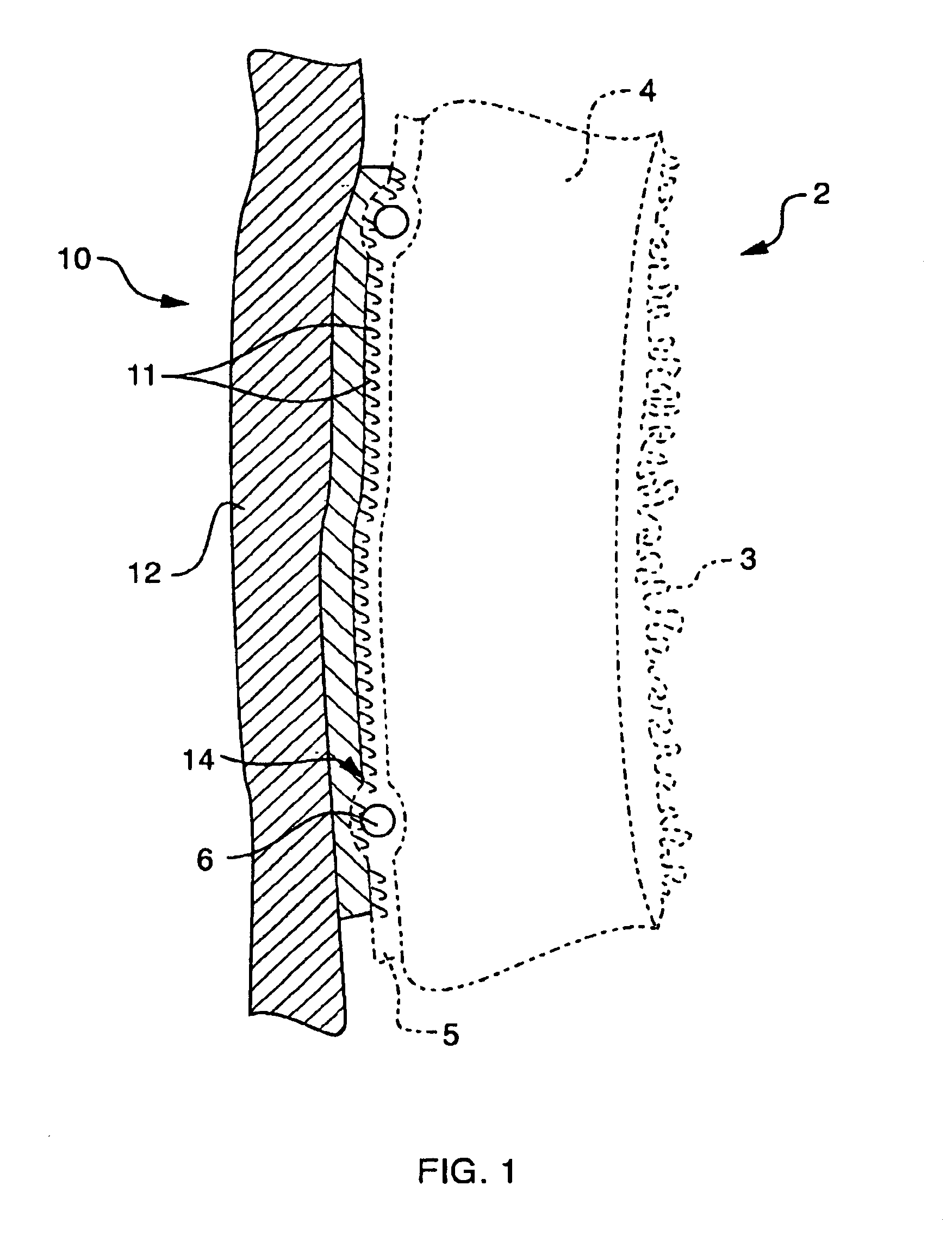 Apparatus and method for detachably securing a device to a natural heart