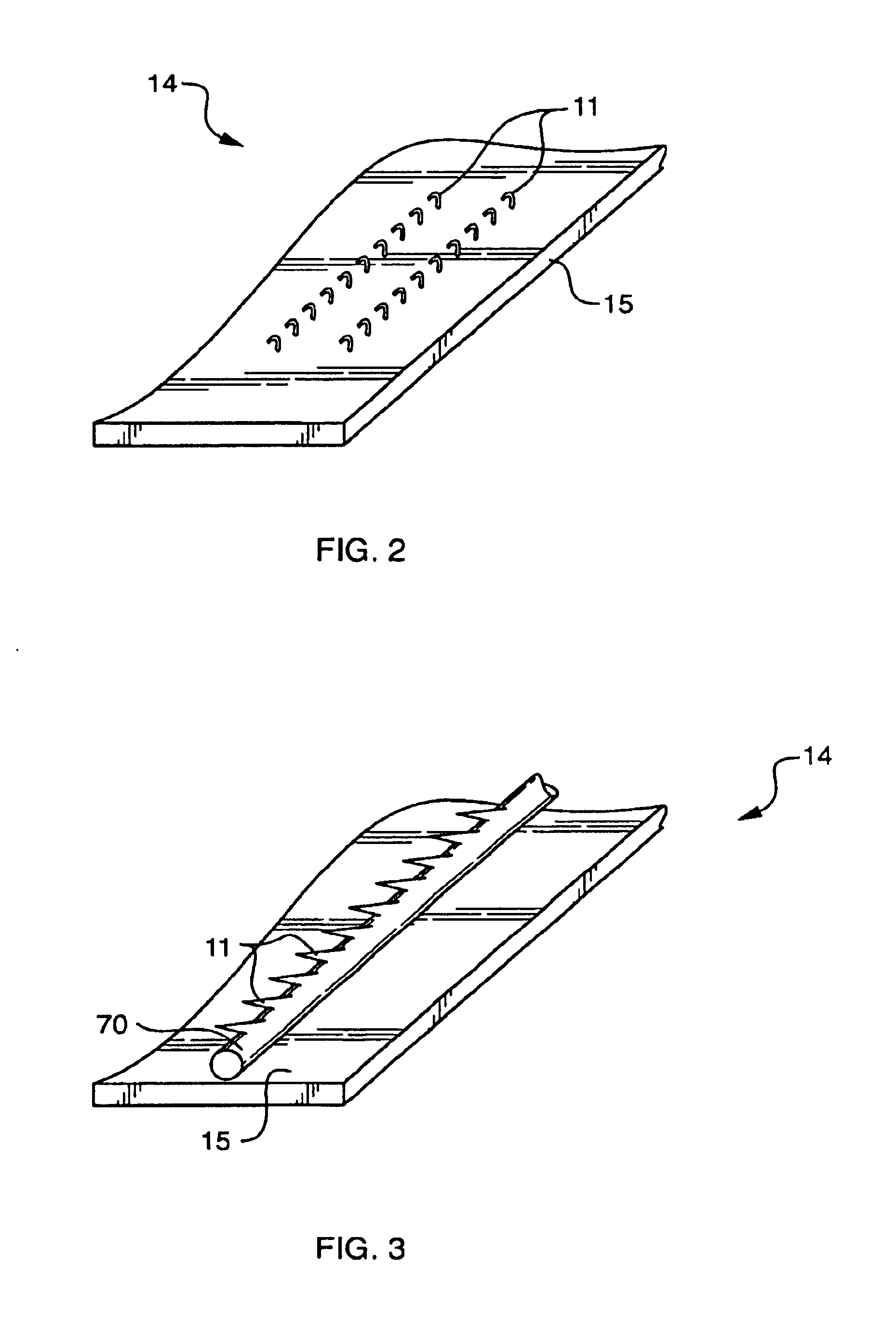 Apparatus and method for detachably securing a device to a natural heart