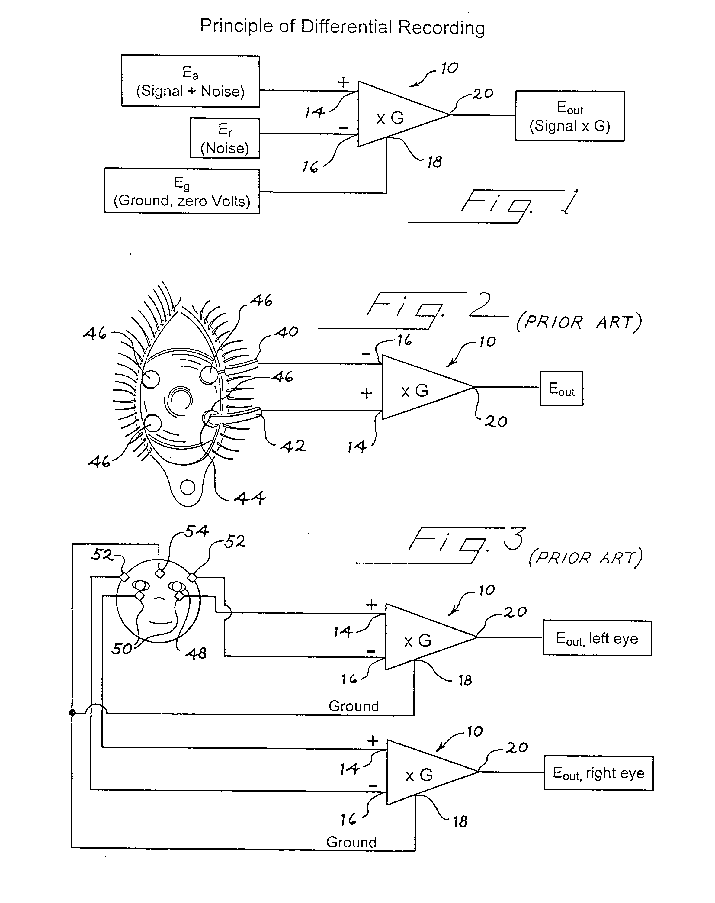 Apparatus and methods for mapping retinal function