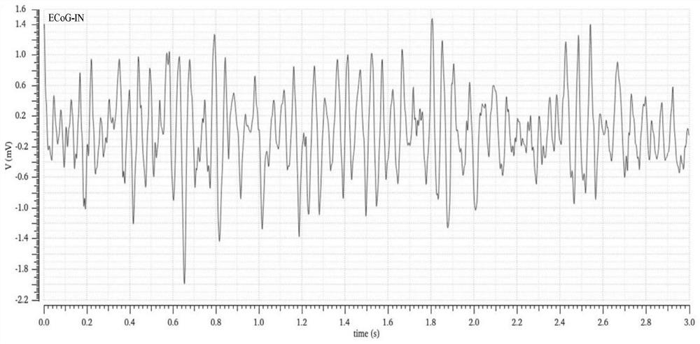 Electric model for conducting cortex electroencephalogram into scalp electroencephalogram