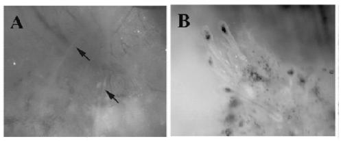 A method for preparing composite film for treating vitiligo by using autologous hair follicle melanocytes