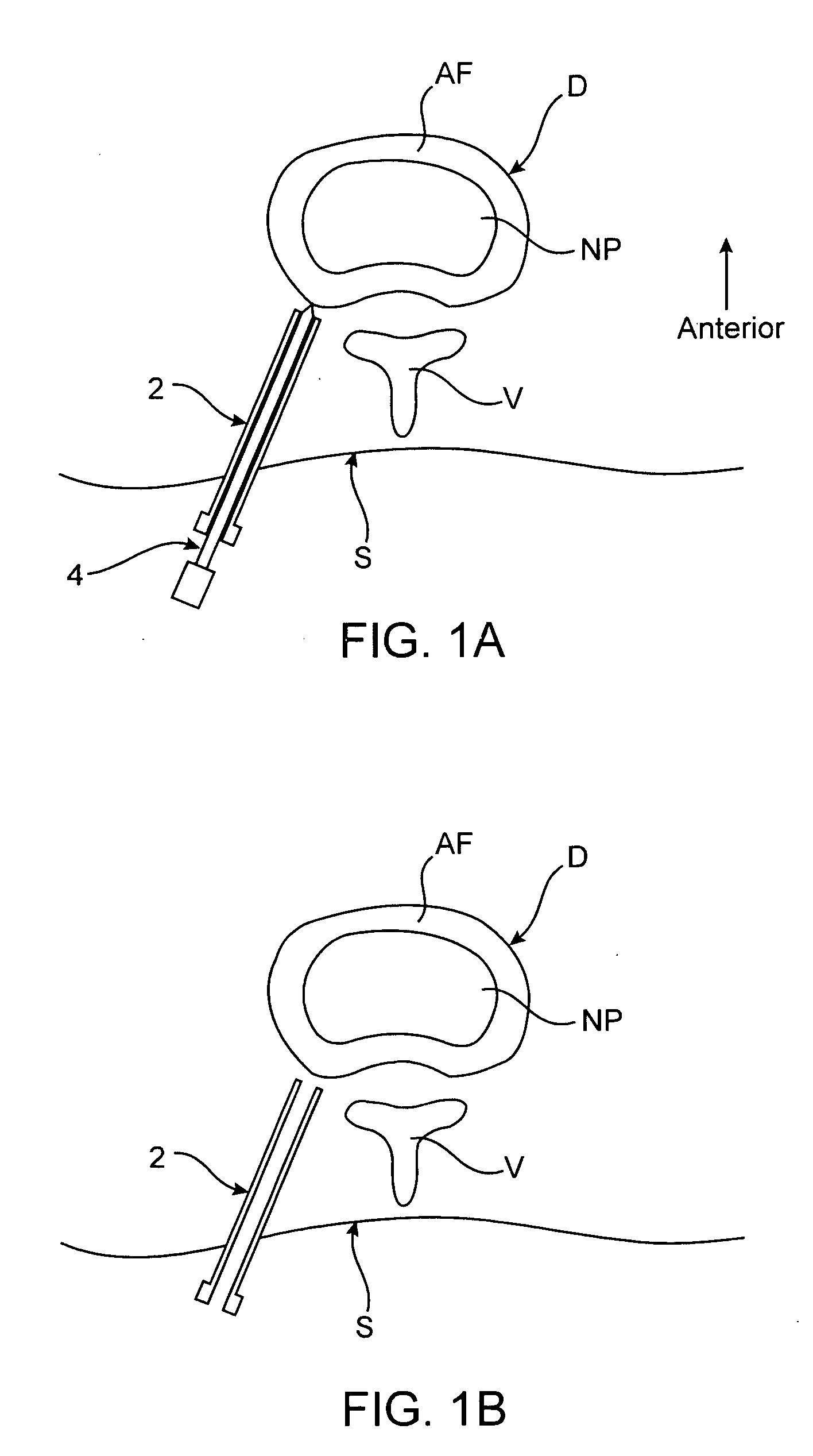 Spinal diagnostic methods and apparatus