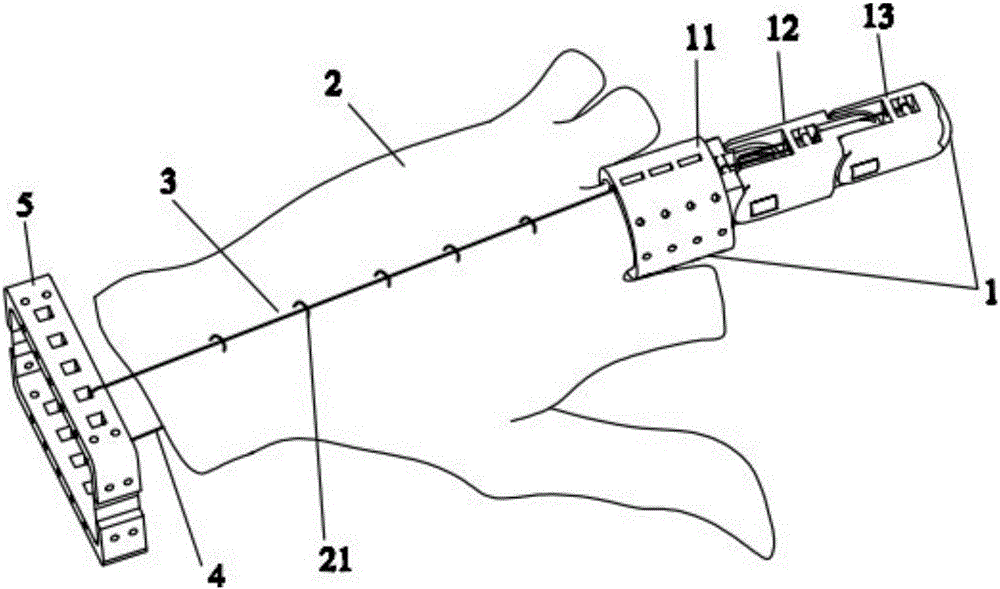 Under-actuated prosthetic hand
