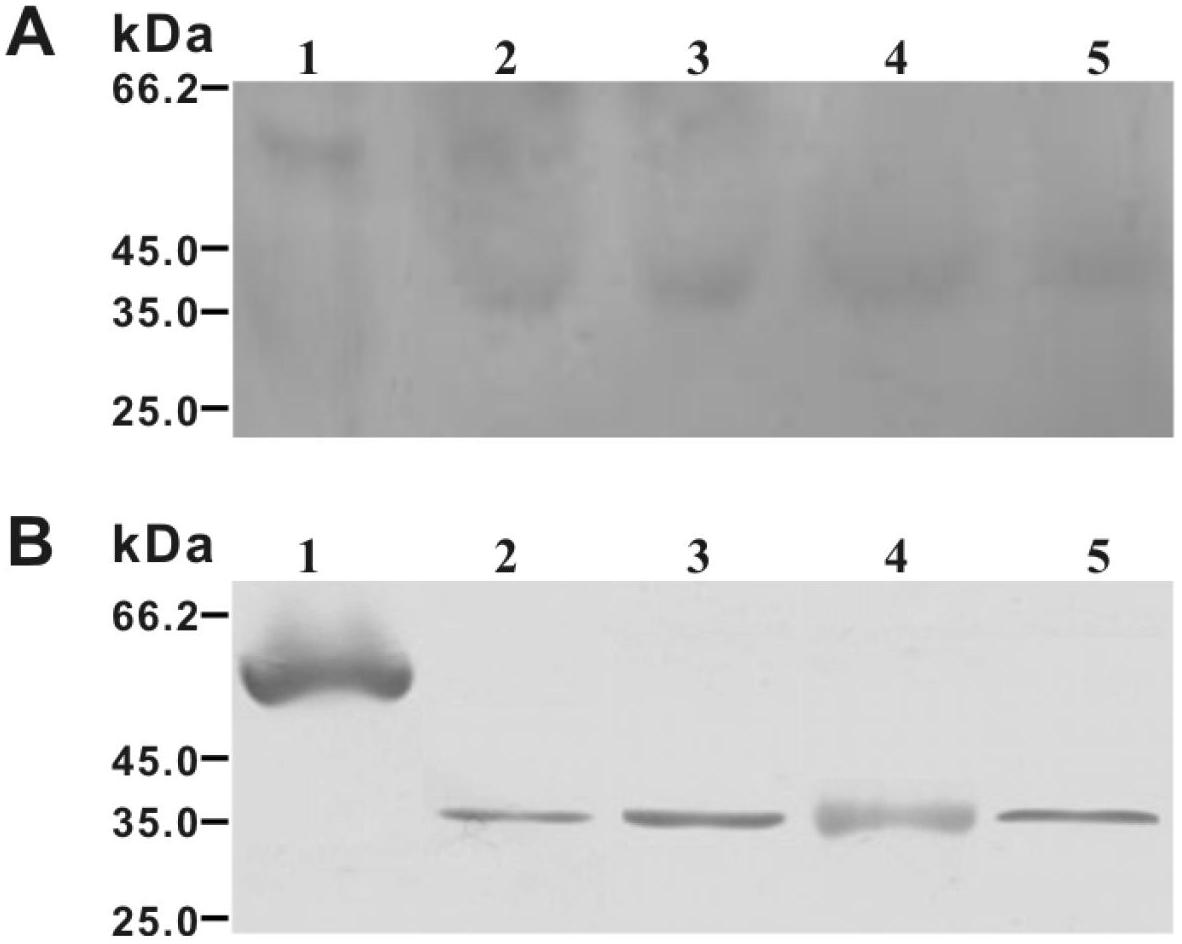 38kDa antigen for Baylisascaris schroederi of giant pandas, preparation method for antigen and application of antigen