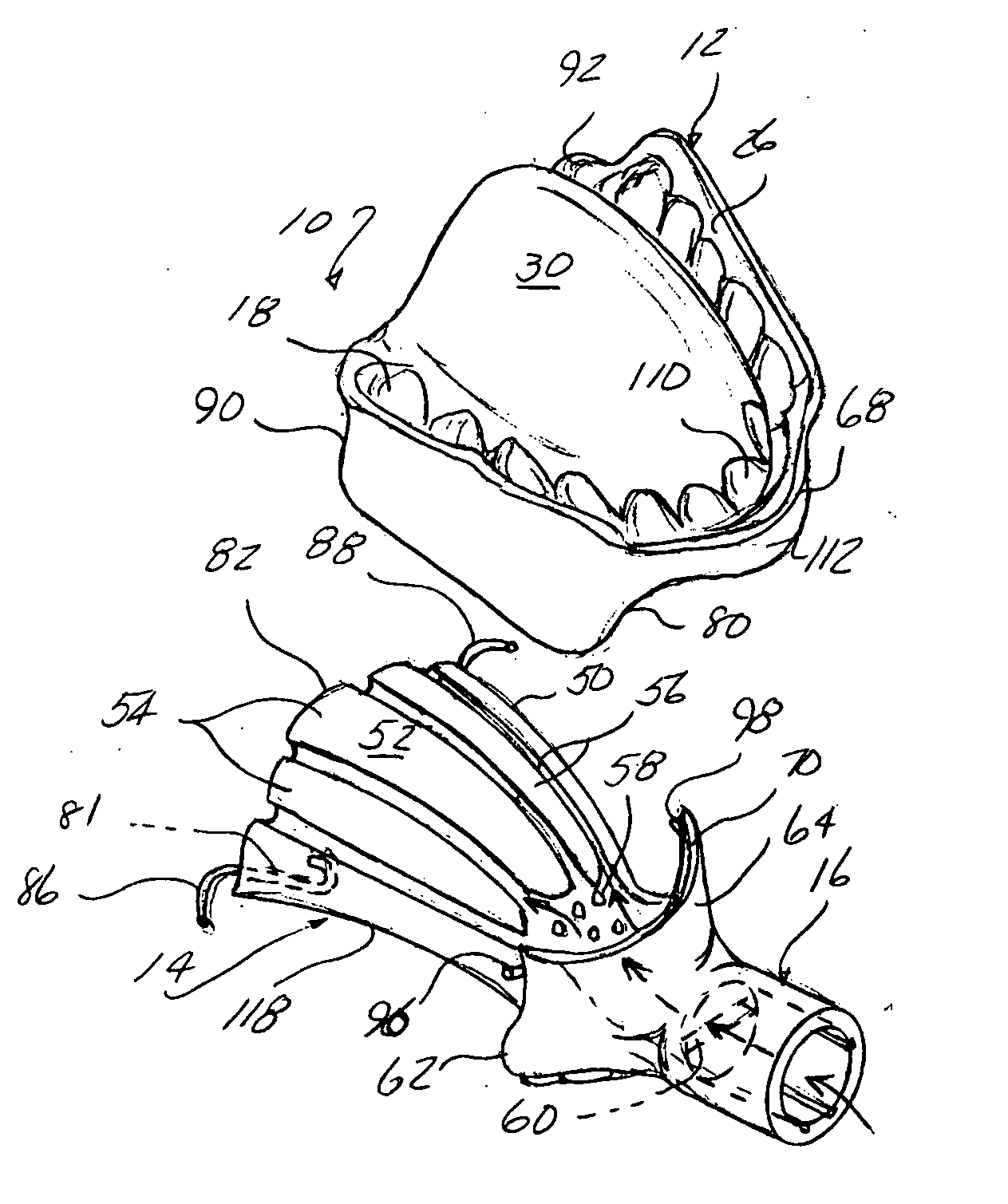 Method and device for addressing sleep apnea and related breathing disorders