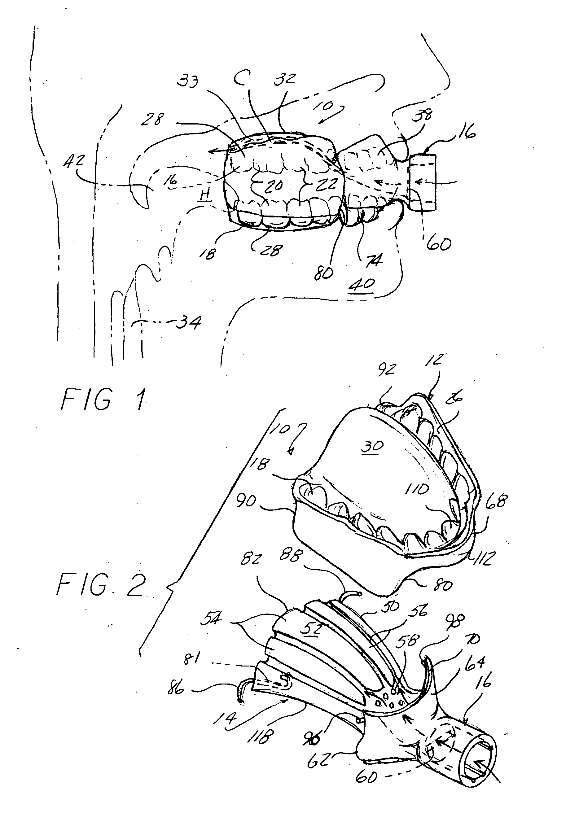 Method and device for addressing sleep apnea and related breathing disorders