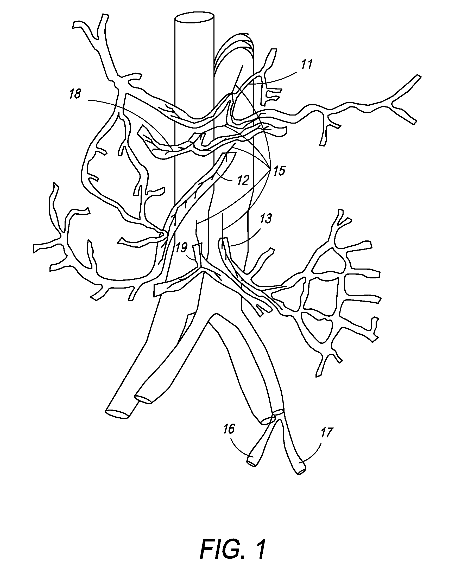 Method and apparatus for stimulating the vascular system