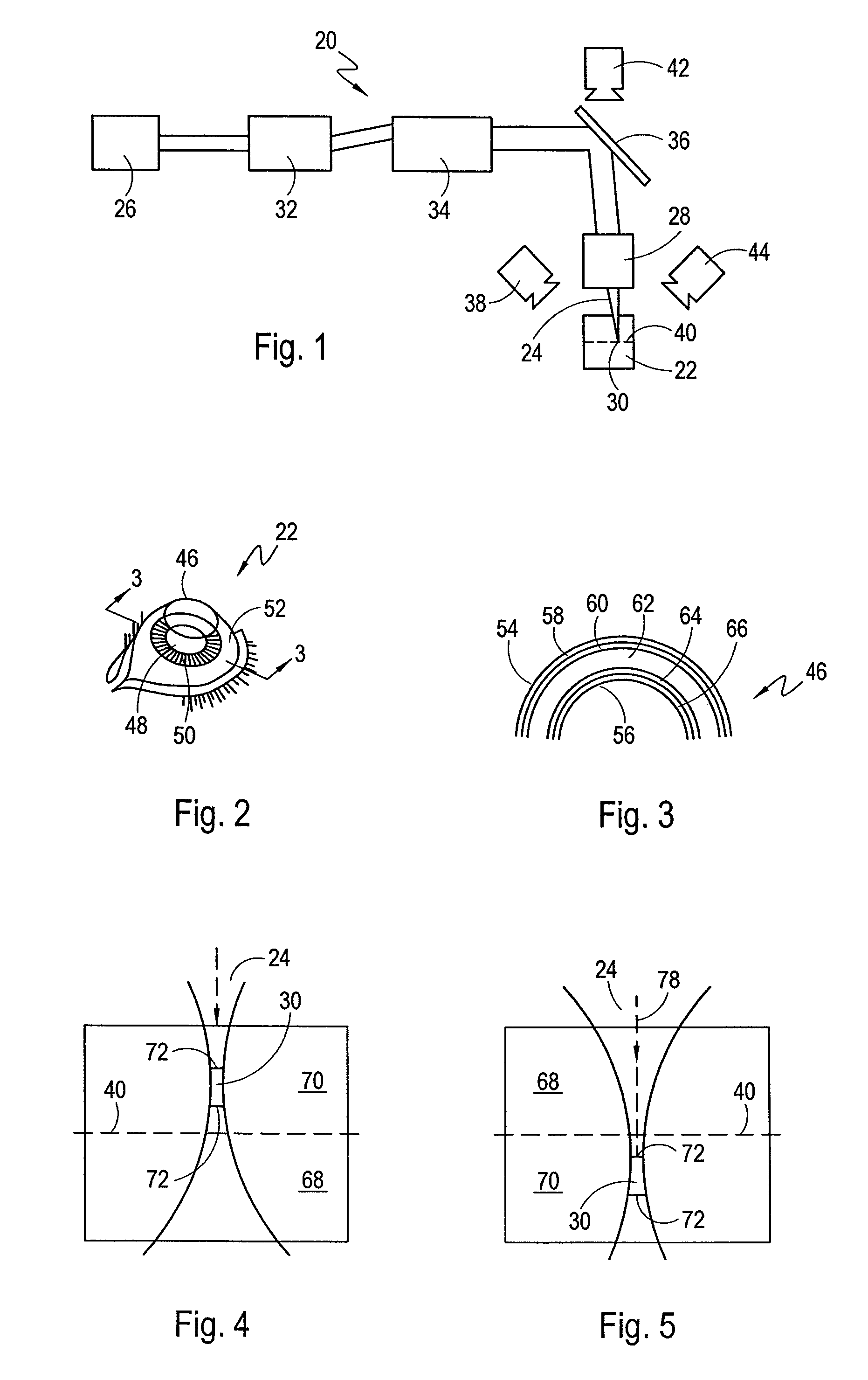Devices and methods for separating layers of materials having different ablation thresholds
