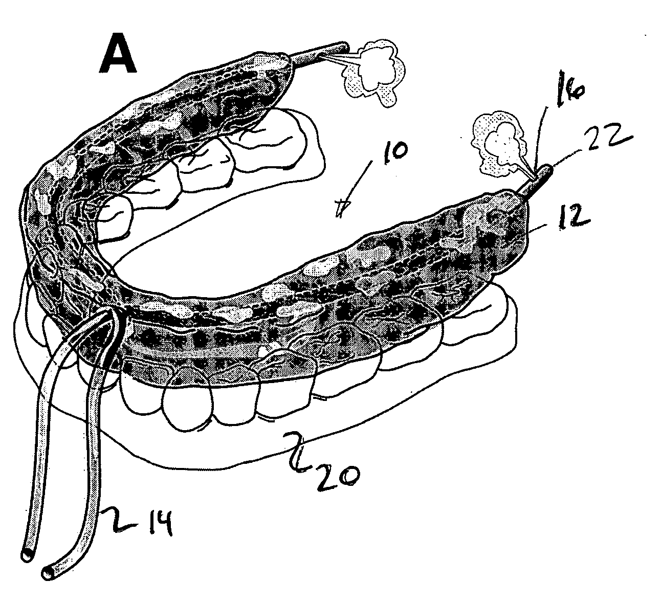 Oral device