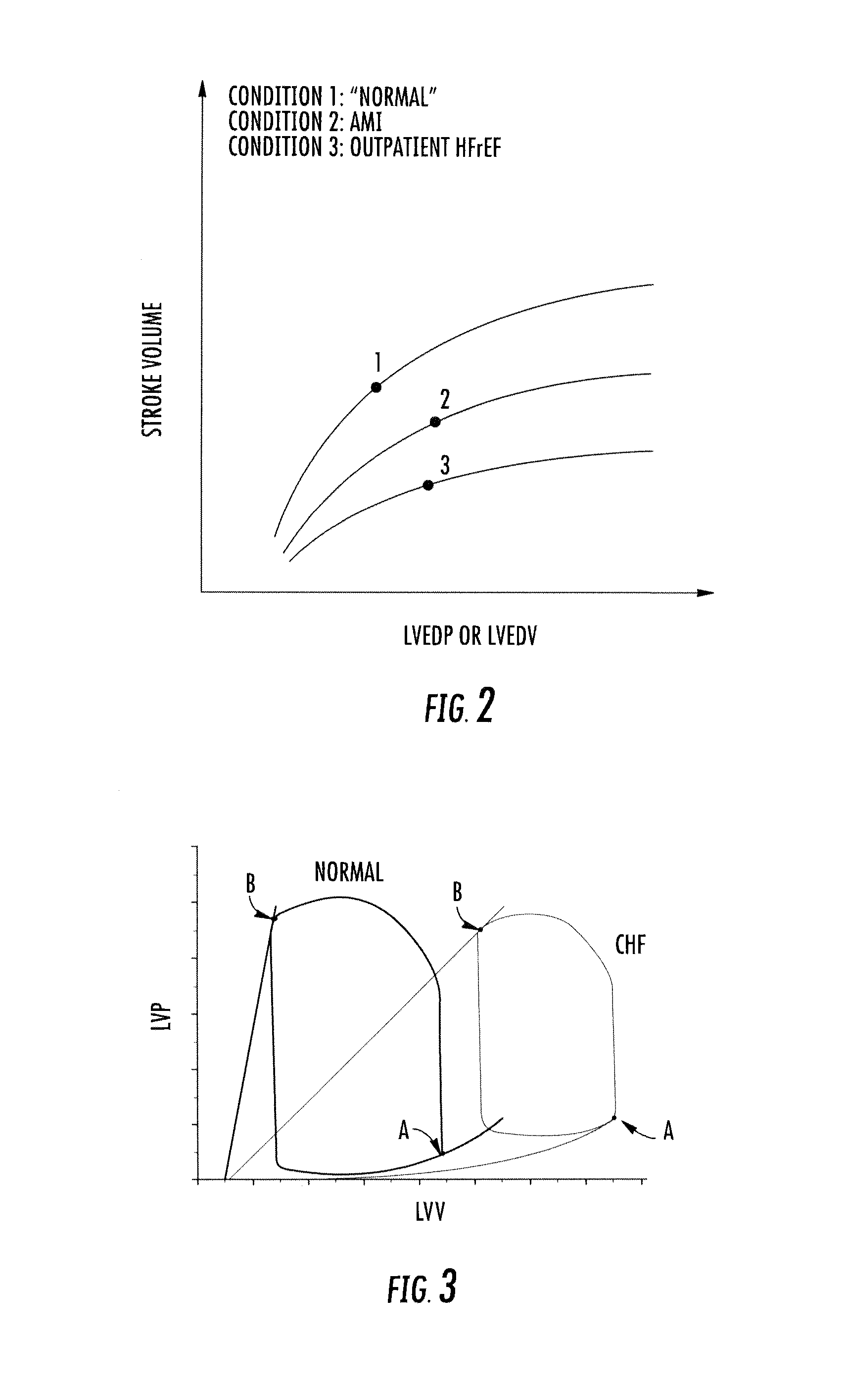 Systems and methods for treating acute and chronic heart failure
