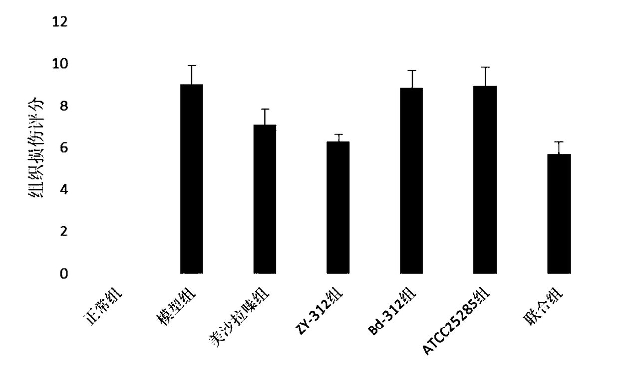 Application of a Bacteroides fragilis in the prevention and/or treatment of inflammatory bowel disease