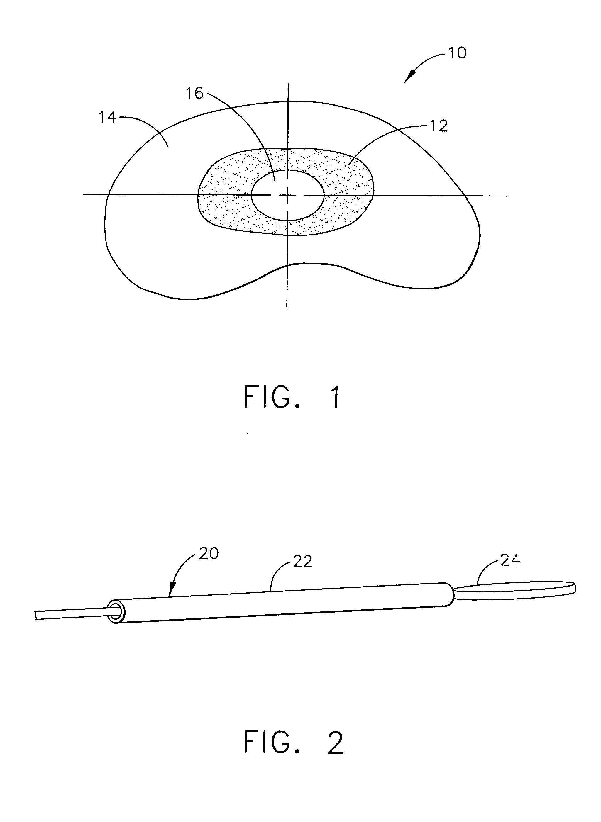 Spinal disc nucleus implant