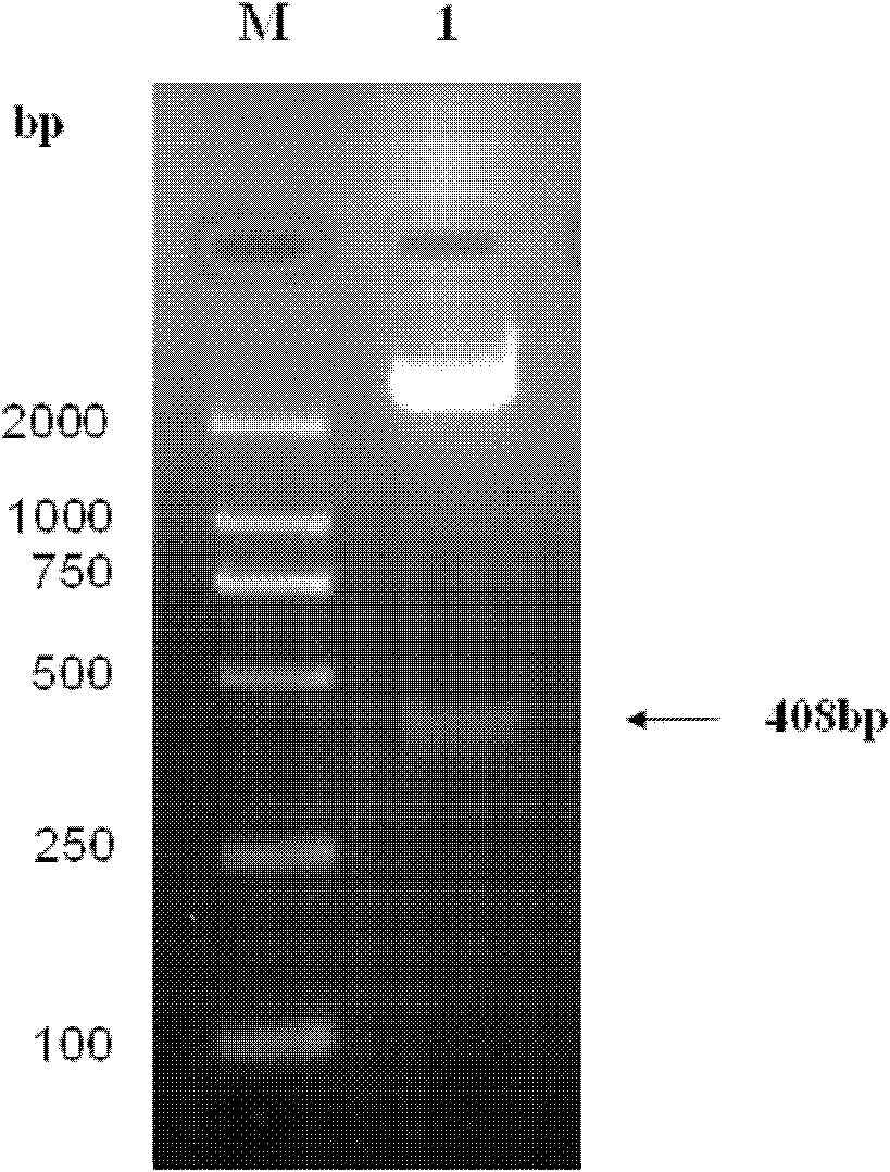 Recombinant galactose agglutinin-1 two-string protein and preparation method thereof
