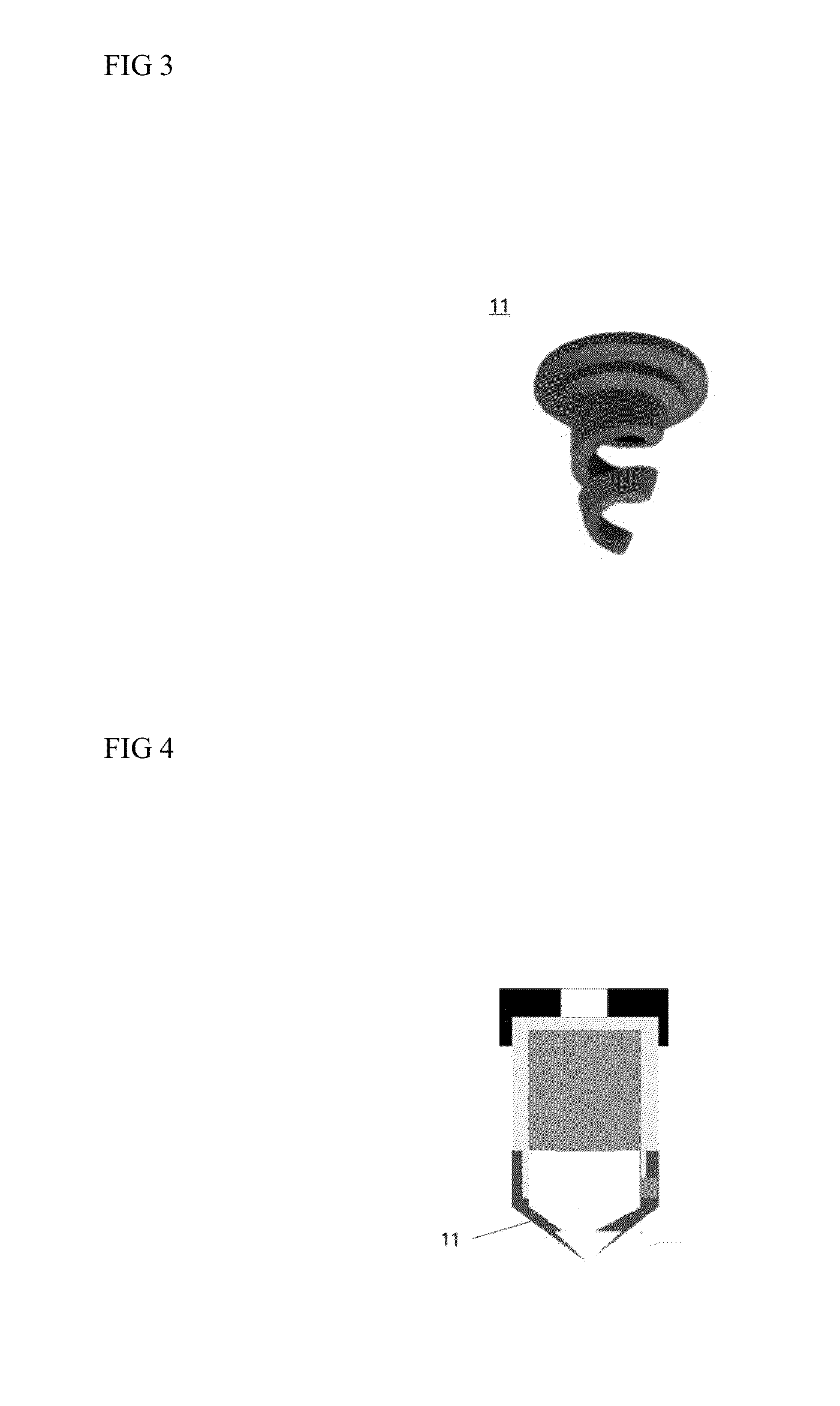 Dental anesthetic injection device