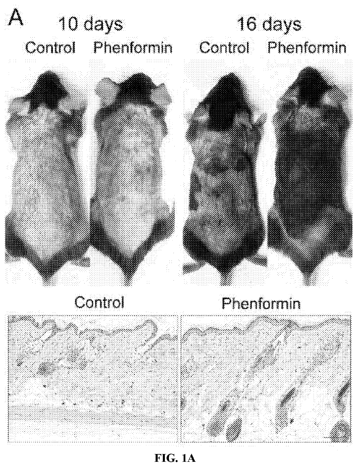 Compositions and methods for modulating hair growth