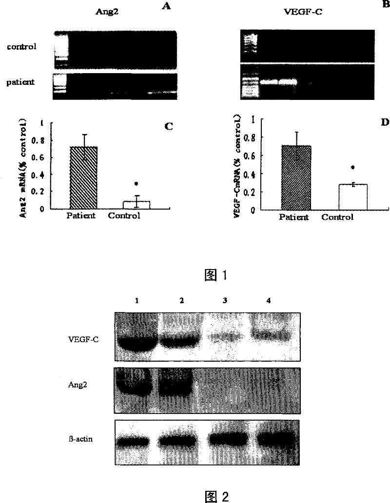 Application of Ang-2 and genes thereof in pharmacy