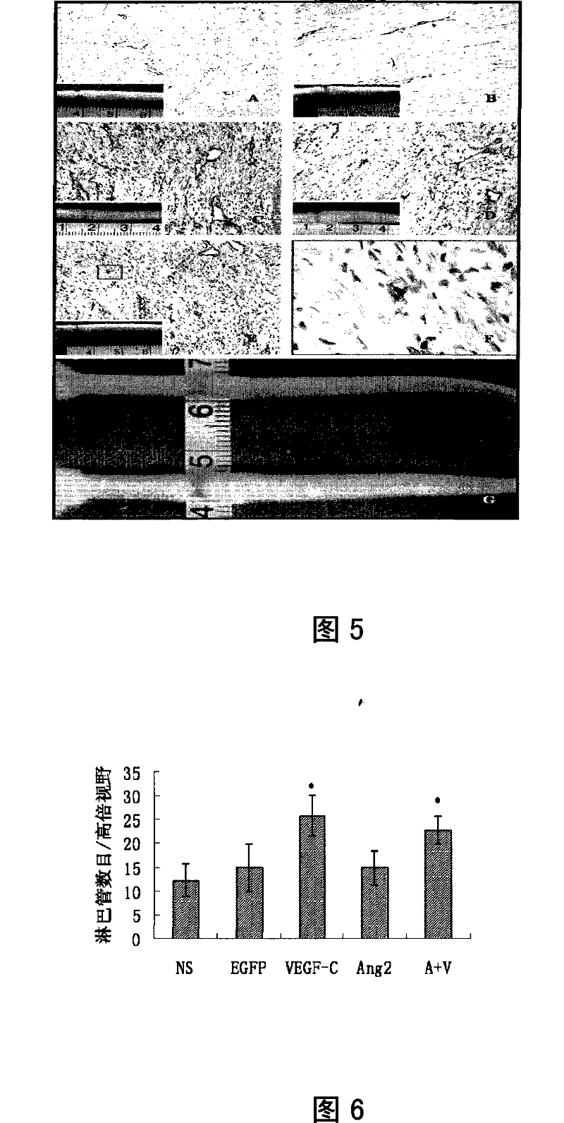 Application of Ang-2 and genes thereof in pharmacy