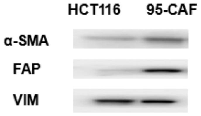 Human tumor-associated fibroblast cell lines and application thereof