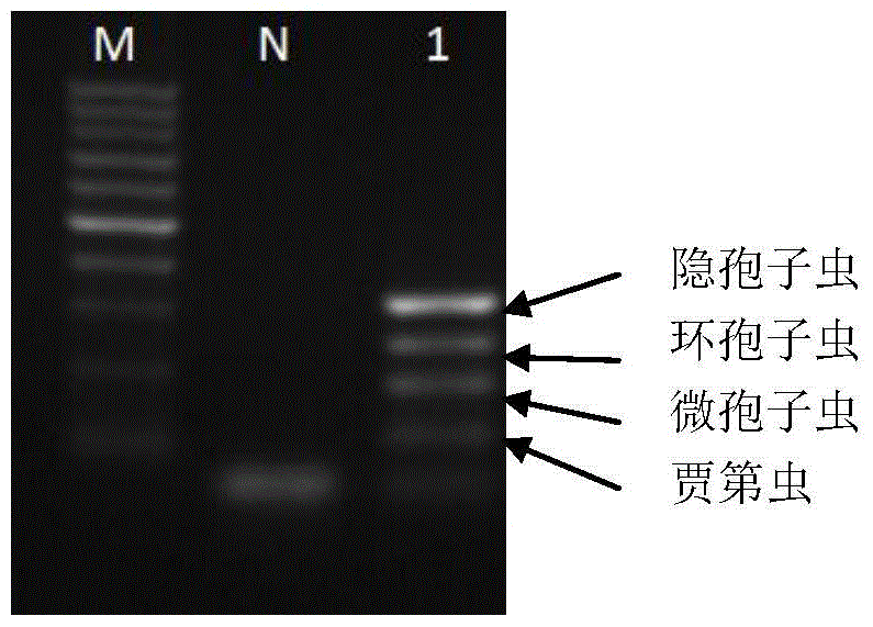 Multiplex pcr detection kit and detection method for new intestinal protozoa