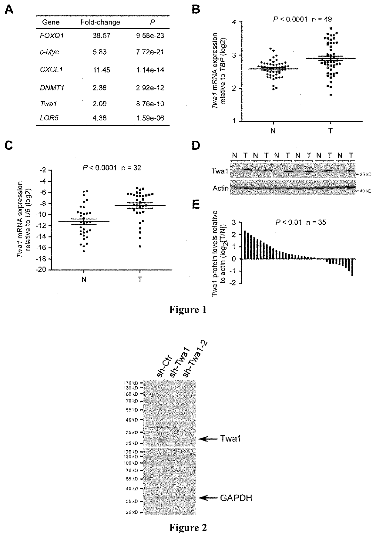 Gene and its expression product promoting the occurrence and development of cancer and application