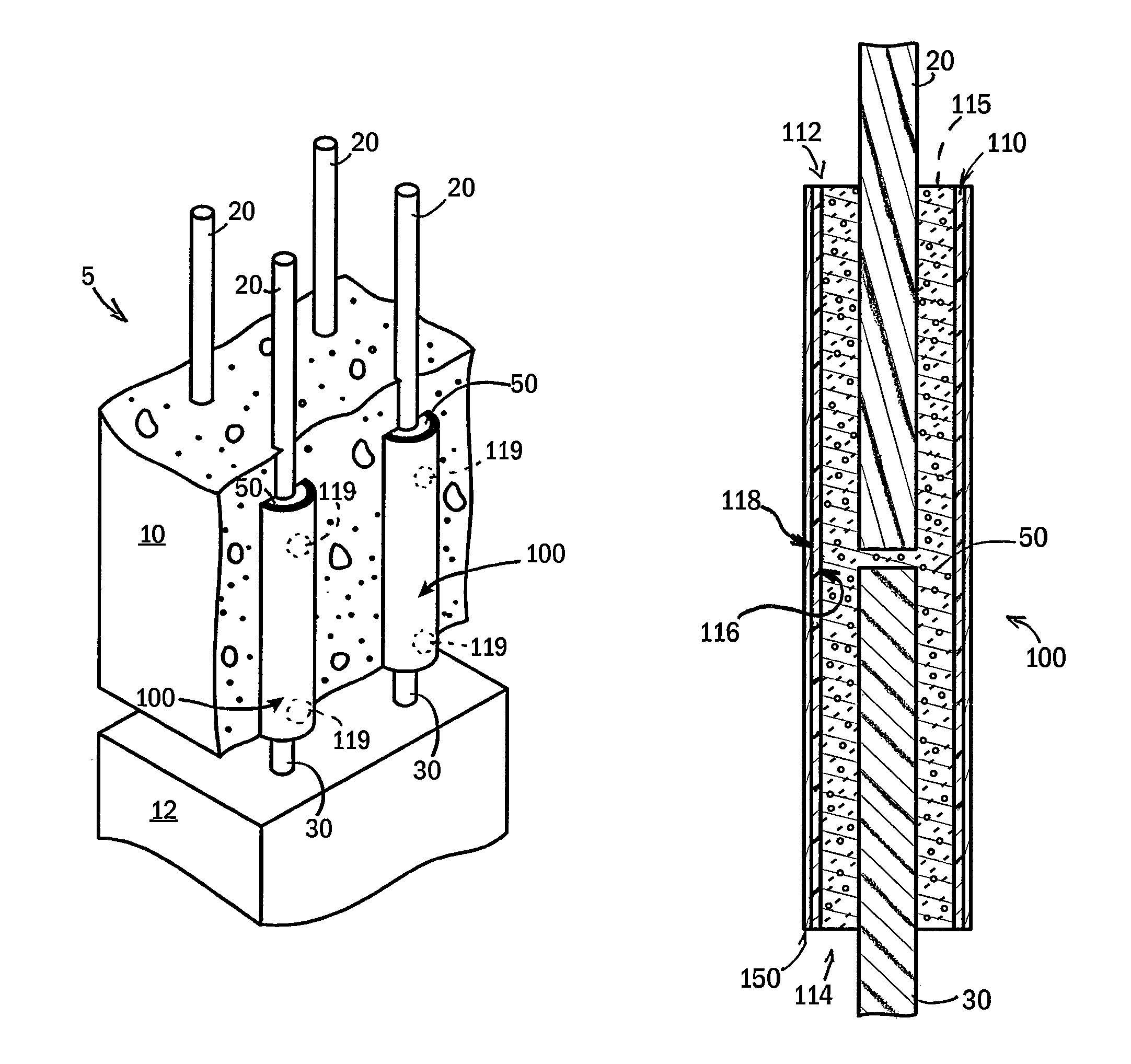Splice system for connecting rebars in concrete assemblies