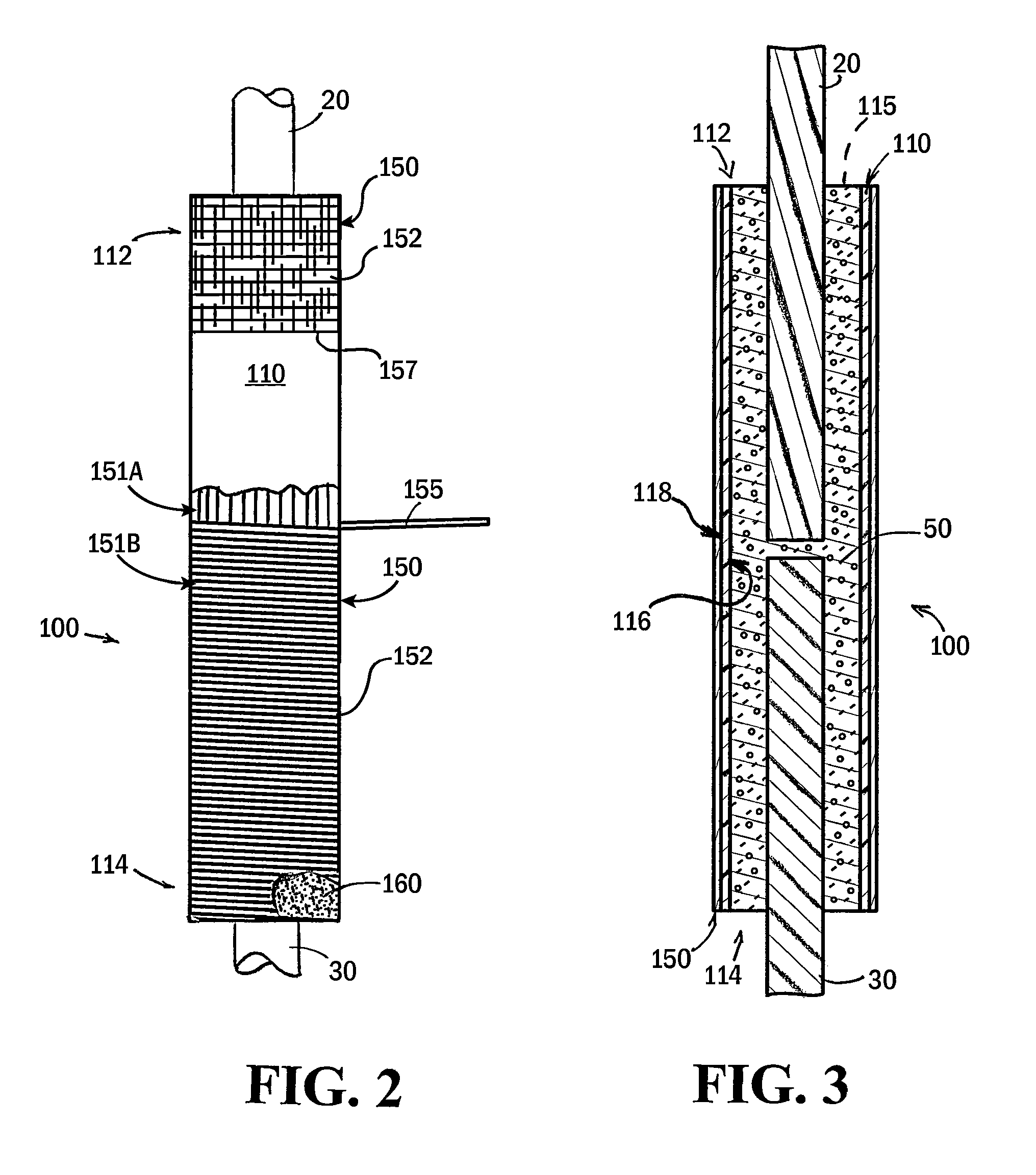 Splice system for connecting rebars in concrete assemblies