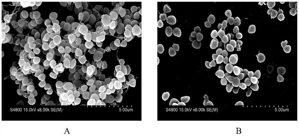 Application of rhein in the preparation of drugs for inhibiting Staphylococcus xylosus biofilm