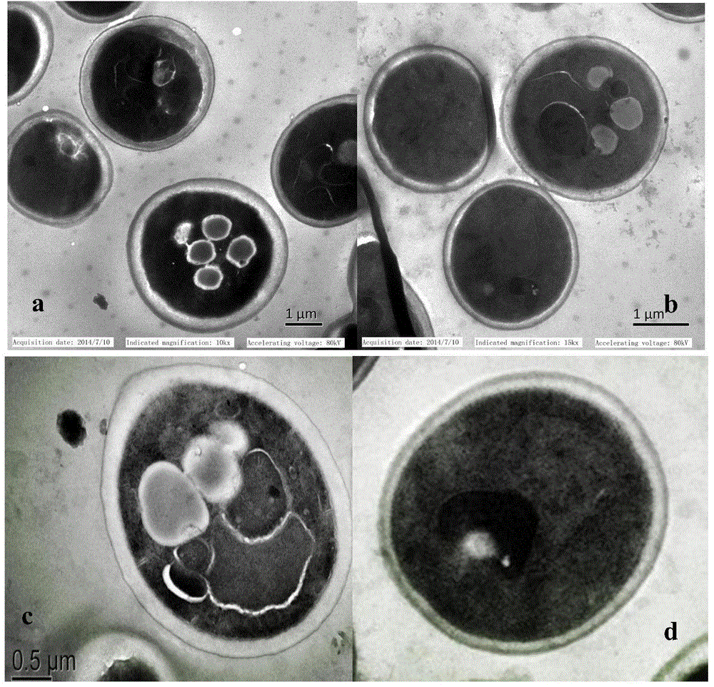 Saccharomyces cerevisiae strain with excellent autolysis resistance