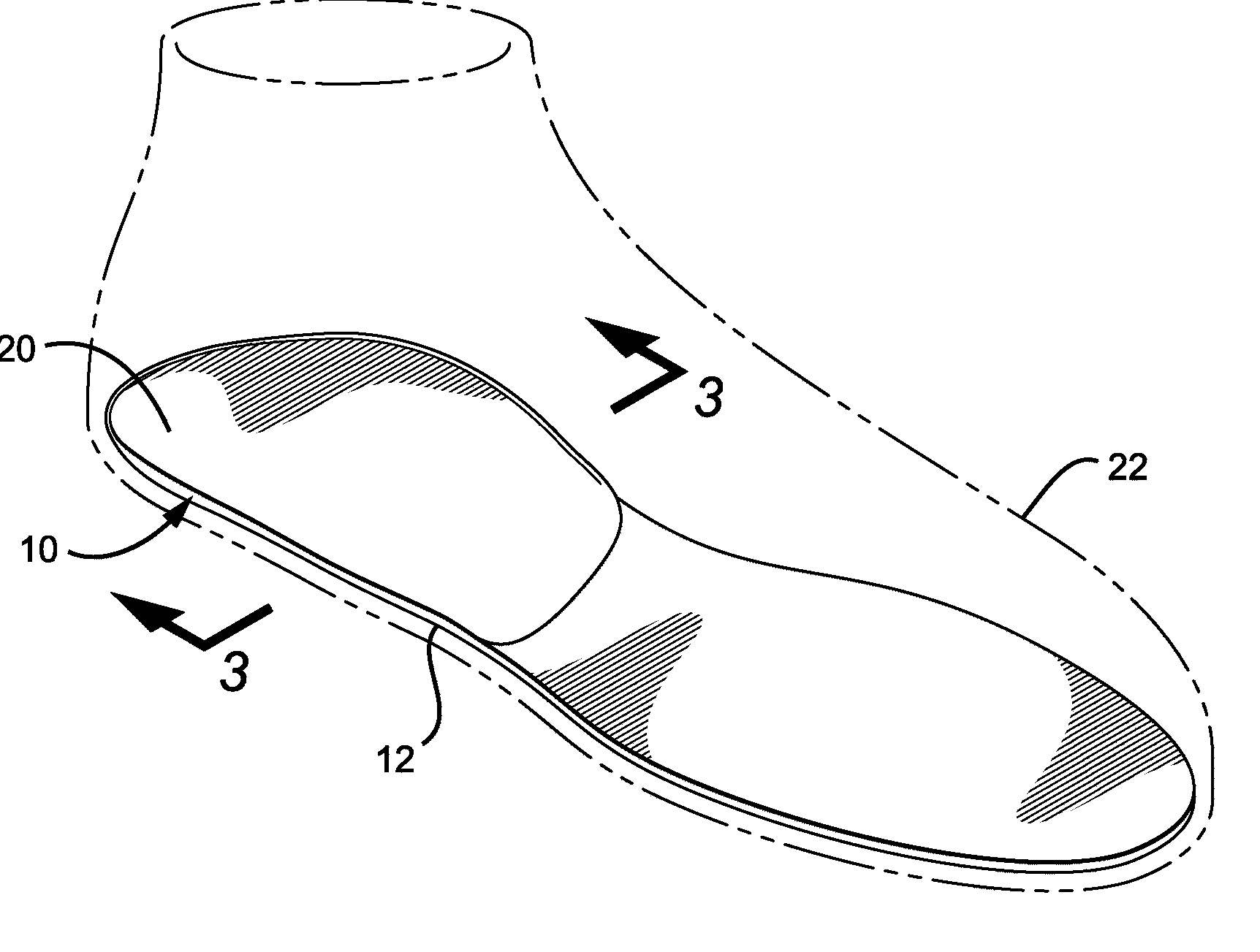 Customized orthopedic sole-insert and method for making