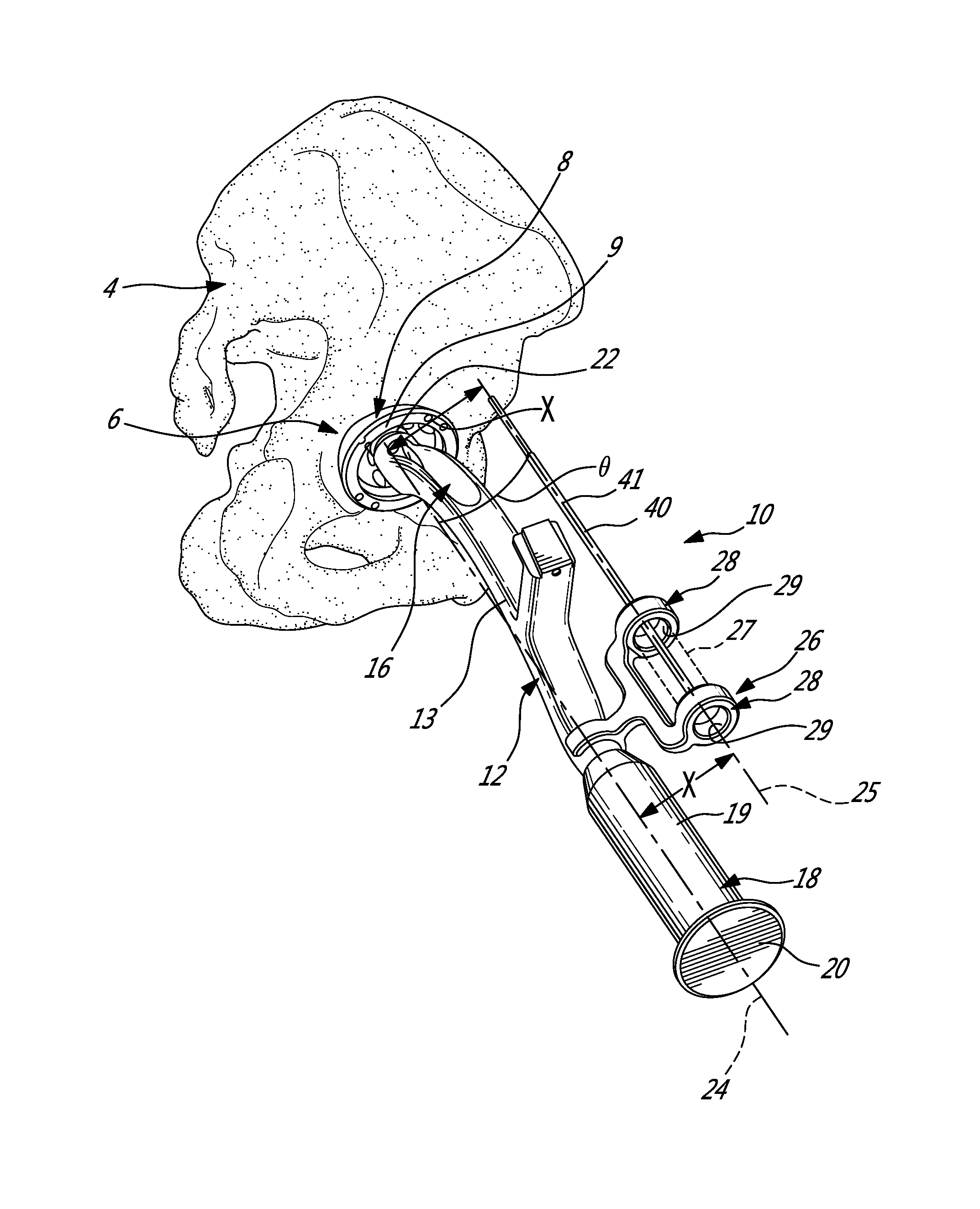 Mechanically guided impactor for hip arthroplasty