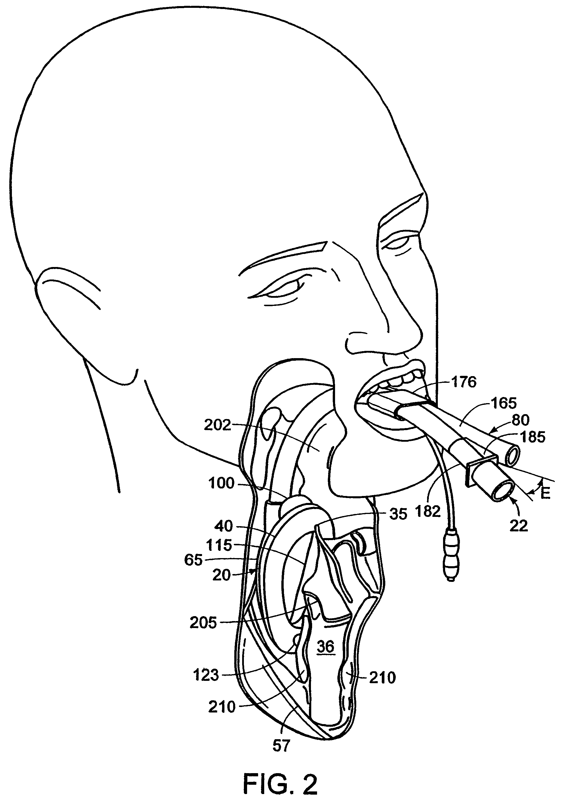 Laryngeal mask airway device