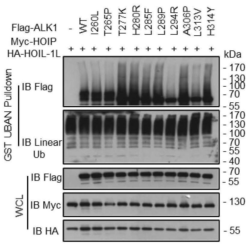 Application of HOIP inhibitor in preparation of medicine for treating type II hereditary hemorrhagic telangiectasia